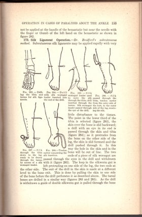 Technique of Operations on the Bones, Joints, Muscles, and Tendons